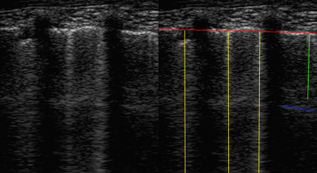 2.6 Understanding medical images